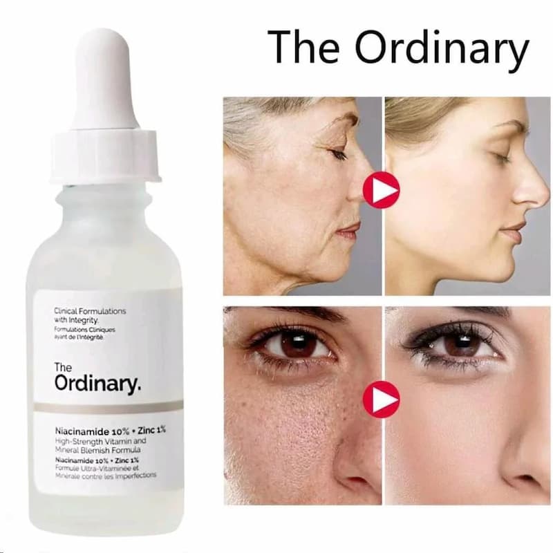 The Ordinary Serum Niacinamide 10% + Zinc 1% 30ml